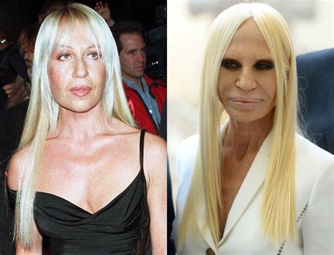 cosa fa oggi donatella versace|donatella versace before and after surgery.